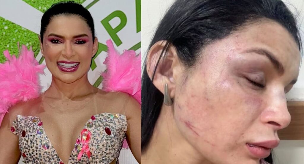 Suspeito de Agredir Musa de Escola de Samba em Manaus é Detido por Falso Motorista de Aplicativo