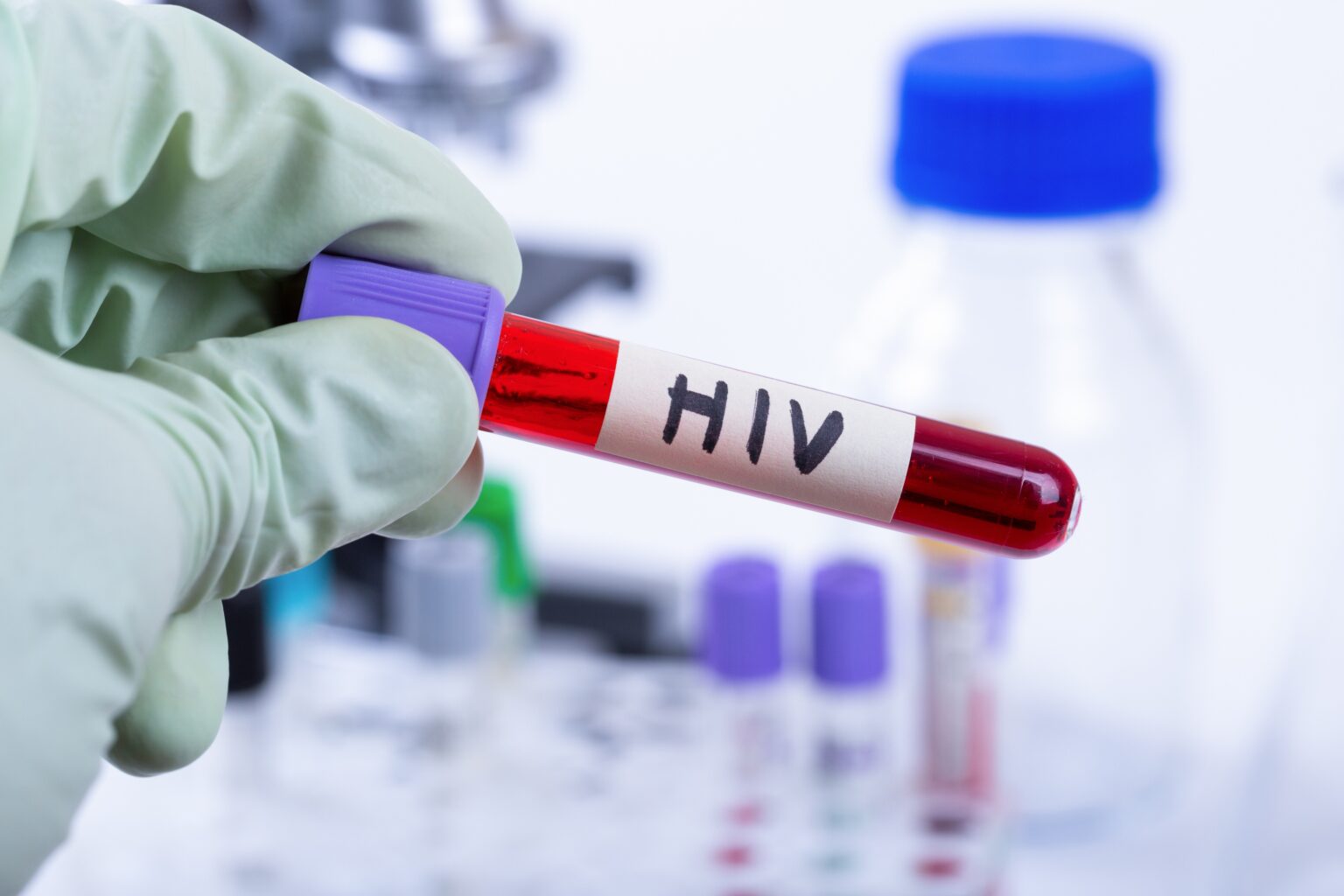 Manaus Participa de Estudo da Fiocruz Sobre Nova Injeção Contra HIV no SUS