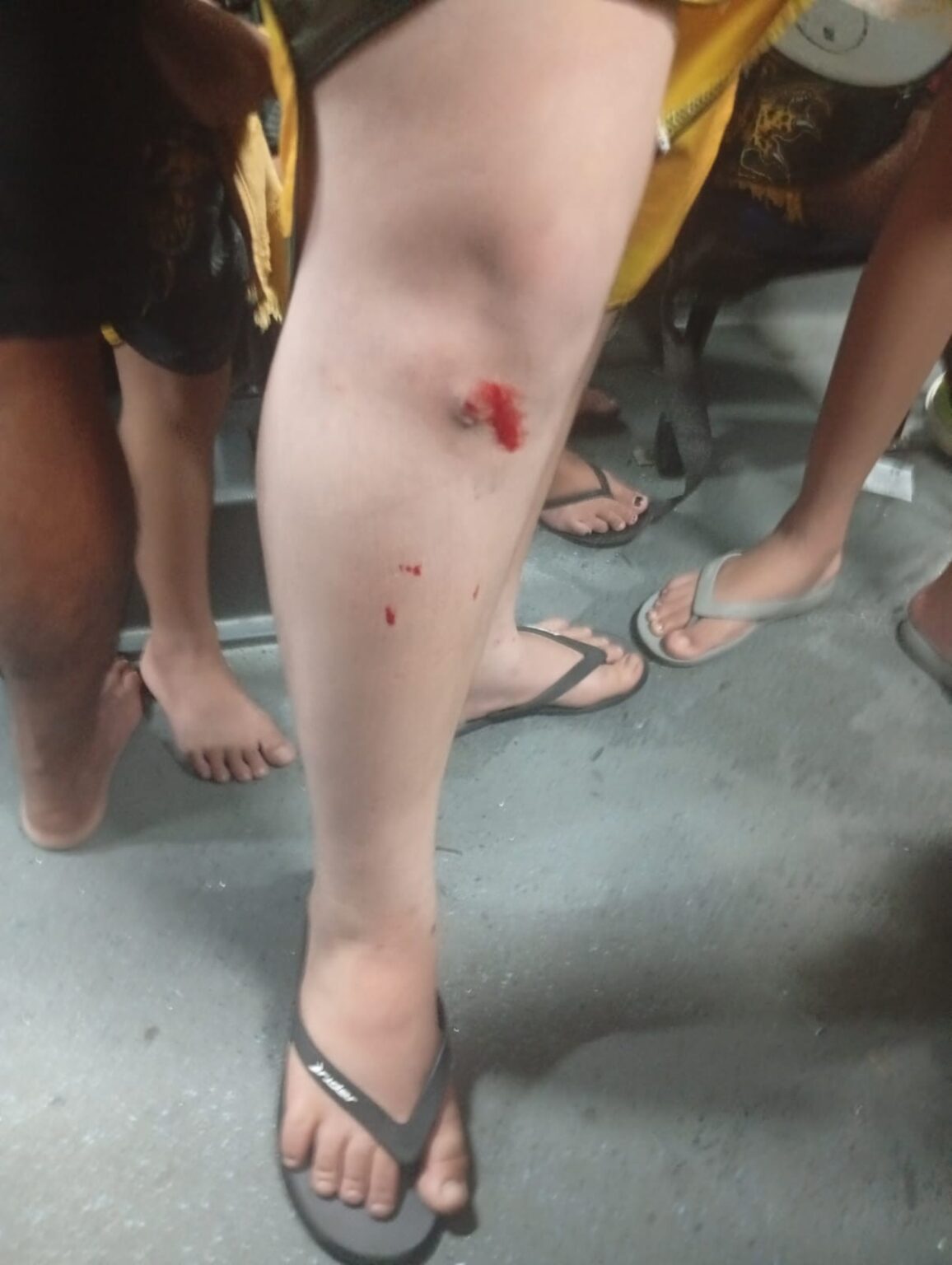 Torcedores do Amazonas Sofrem Ataque em Ônibus Após Jogo Contra o Manaus