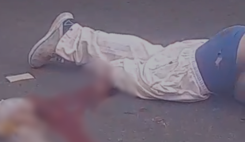 Acidente Grave em Manaus: Motociclista Sofre Amputação de Perna Acidente Grave em Manaus: Motociclista Sofre Amputação de Perna