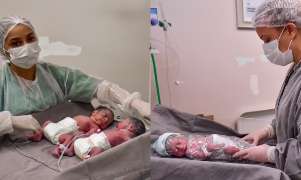 Parto Raro de Trigêmeos em Manaus: Uma História de Superação e Esperança
